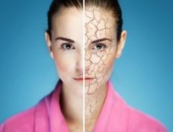 Cara Mengatasi Kulit Kering agar Tampil Sehat Seharian